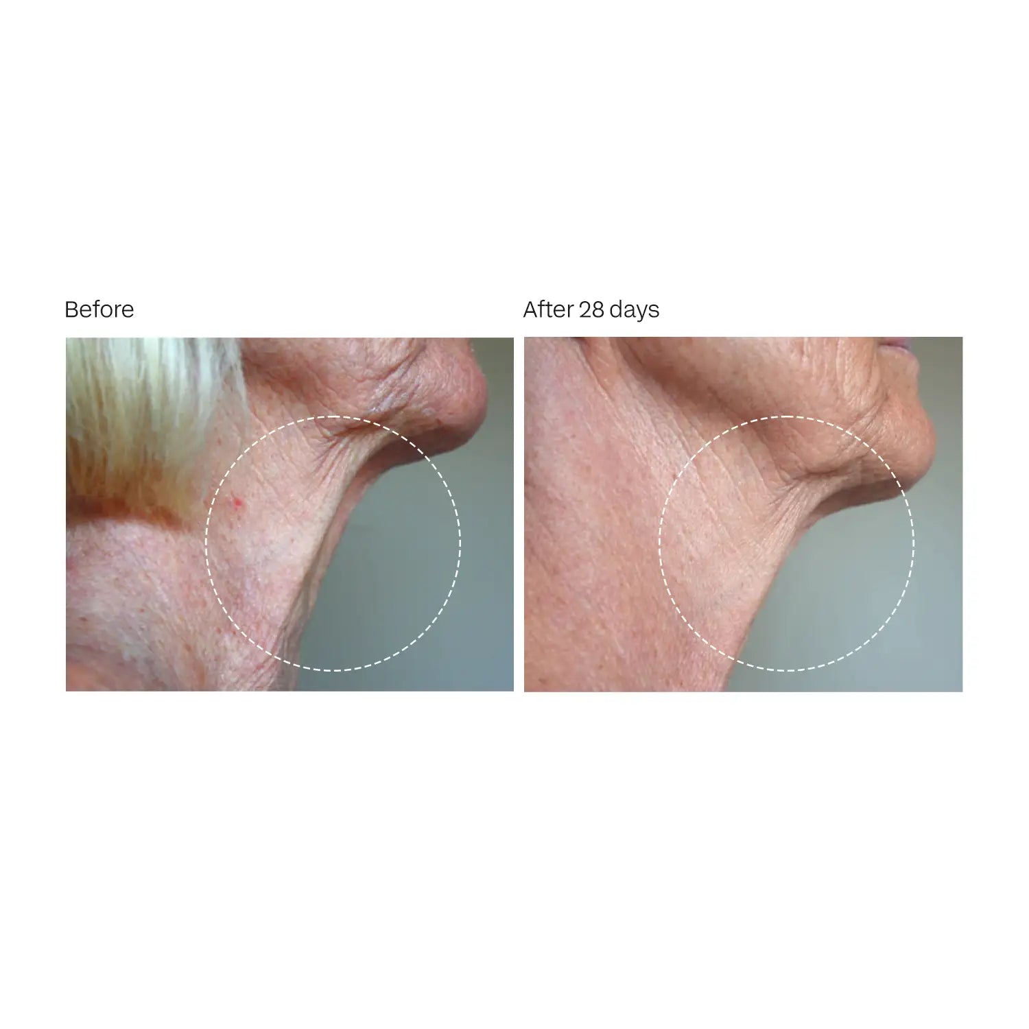 Advanced Formula | 30-Day Supply Packets