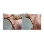 Advanced Formula | 30-Day Supply Packets