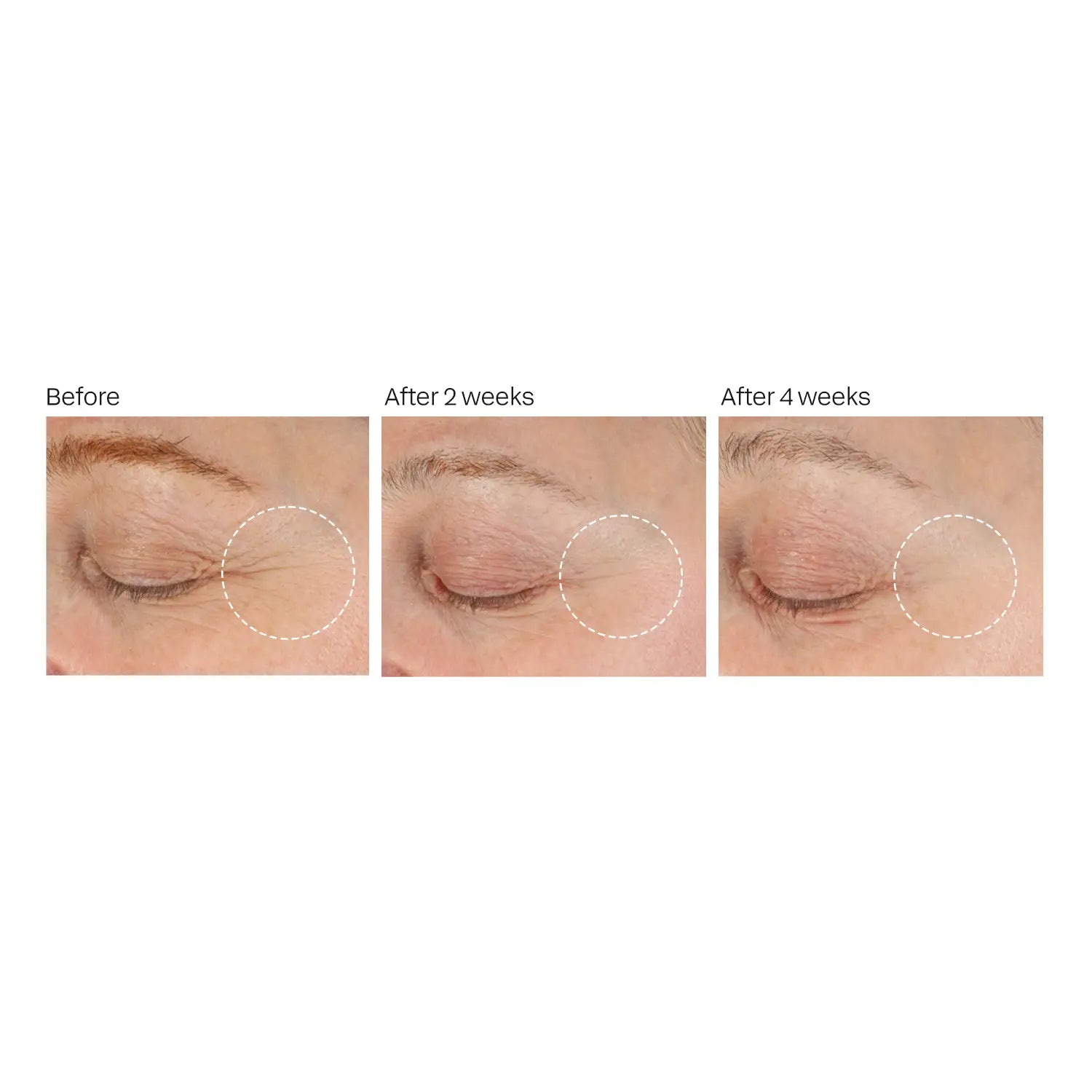 Bright & Firm Eye Treatment – MEG 21 Skincare