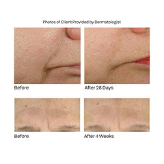 Anti-Aging Face Treatment with Supplamine® – Hydrate & Restore Skin