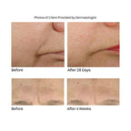 Anti-Aging Face Treatment with Supplamine® – Hydrate & Restore Skin