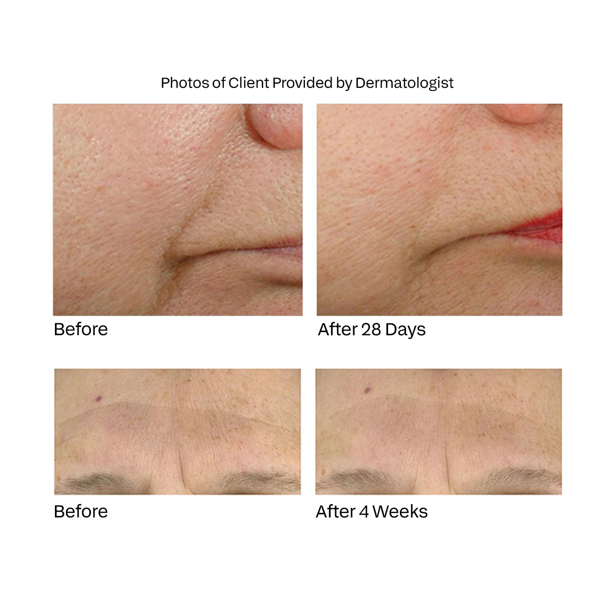 Anti-Aging Face Treatment with Supplamine® – Hydrate & Restore Skin
