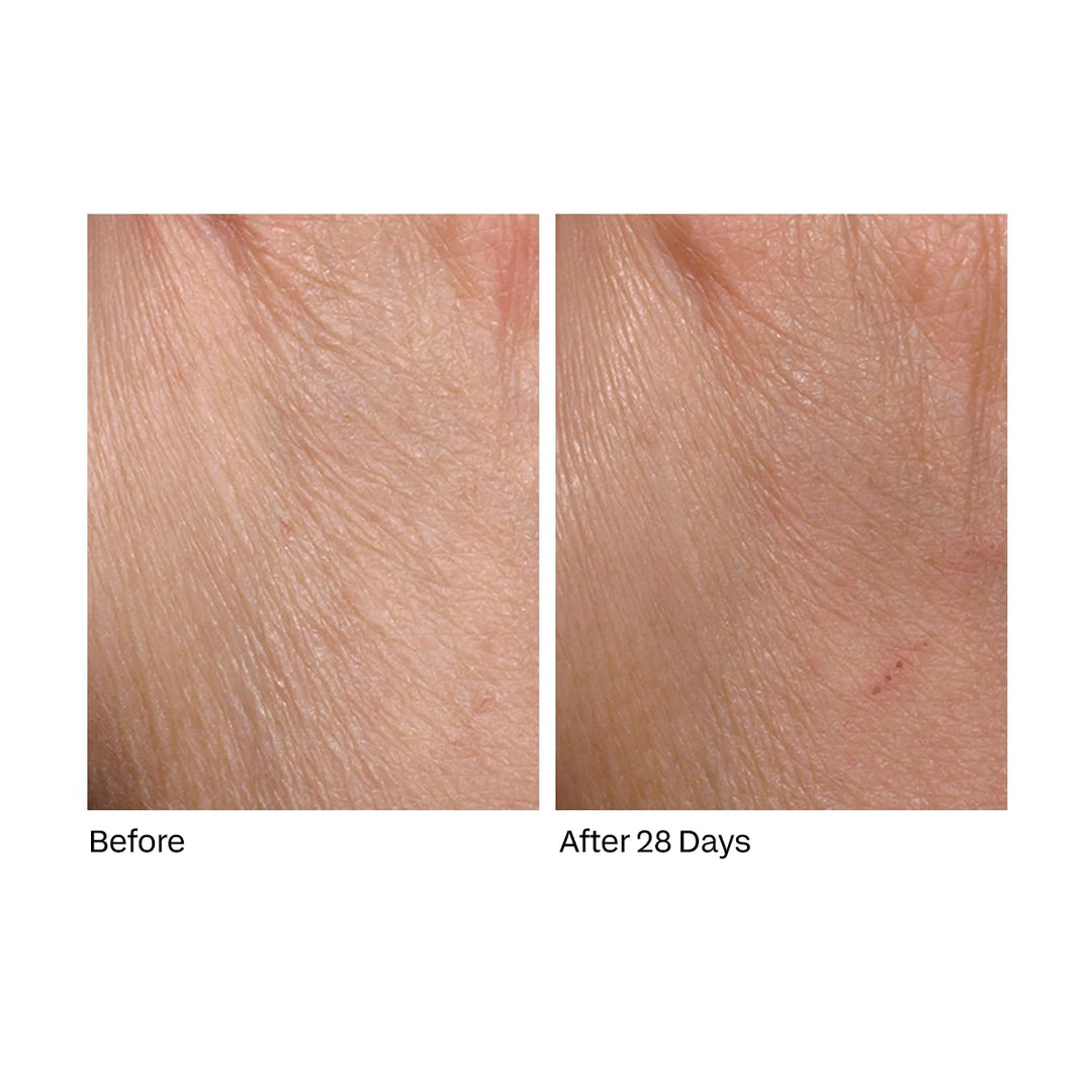 Age Defying Hand Treatment