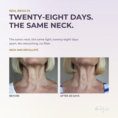 MEG 21 Décolleté Treatment slide: real results, neck and décolleté before and after 28 days