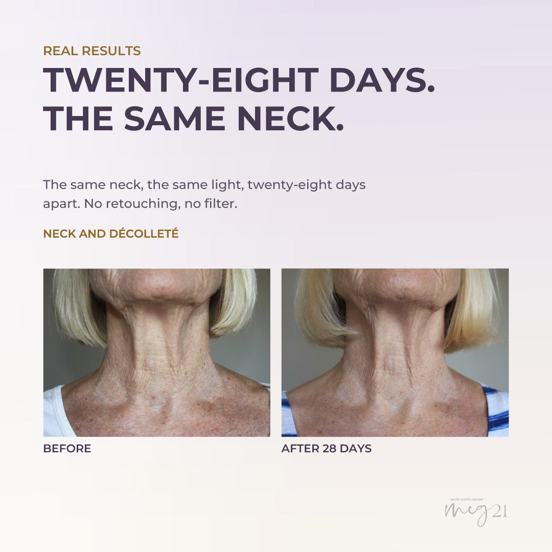 Décolleté Treatment Advanced Formula
